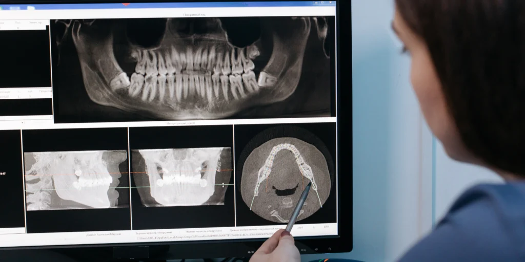 Dental Xray - Smilodon Dental + Implants - Nashville