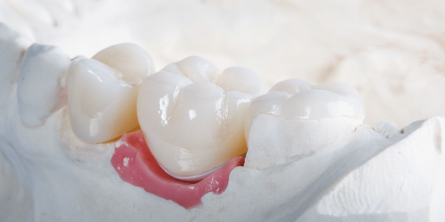 Teeth
