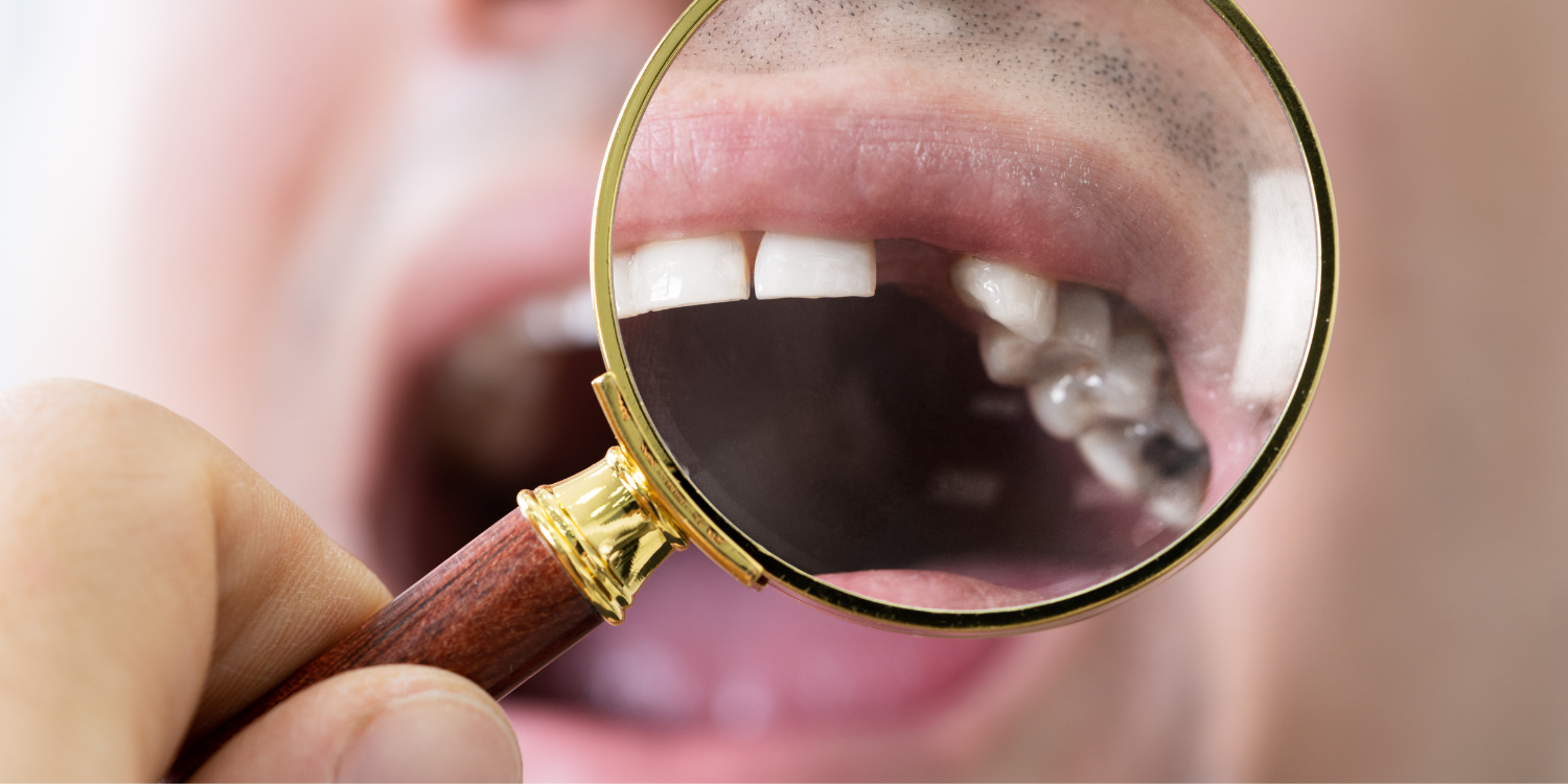 Smilodon Dental + Implants - Implants