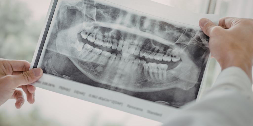 Smilodon Dental + Implants - Xrays
