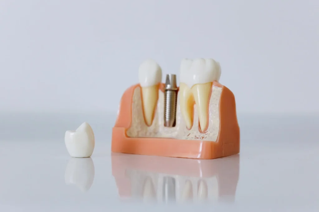Oral Health - Smilodon Dental + Implants - Nashville