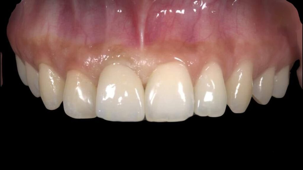 Smilodon Dental + Implants