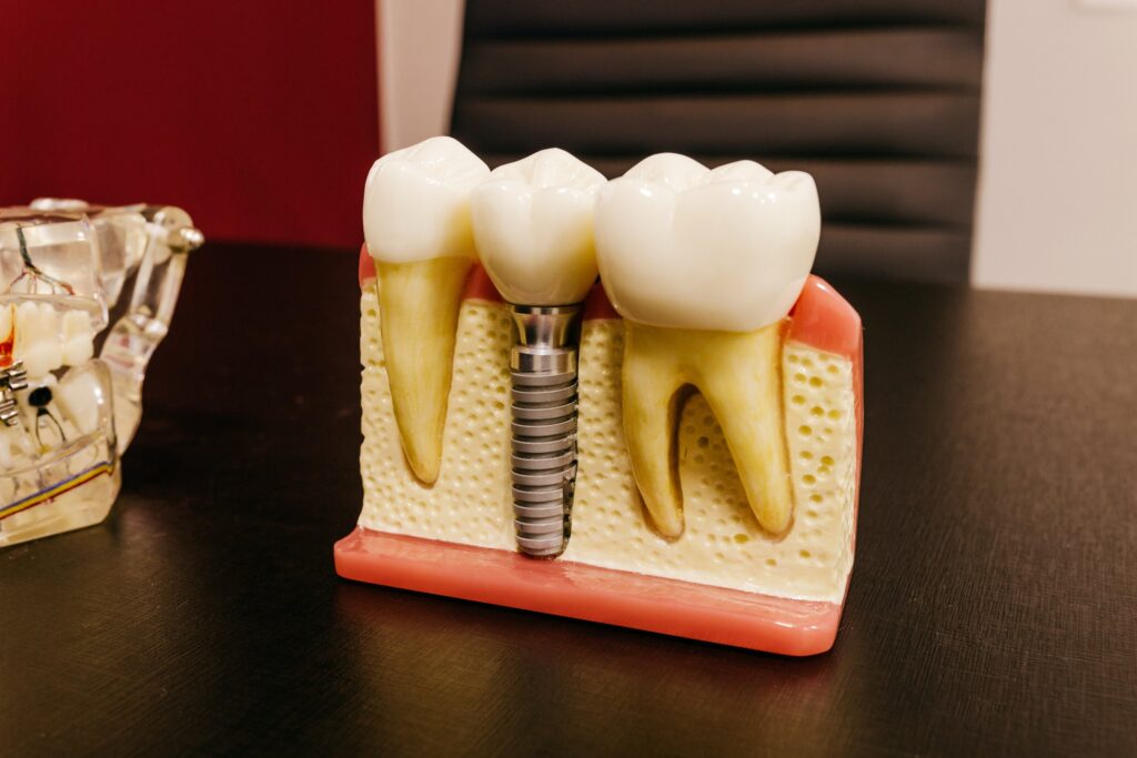 Smilodon Dental + Implants