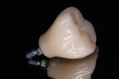 Smilodon Dental + Implants