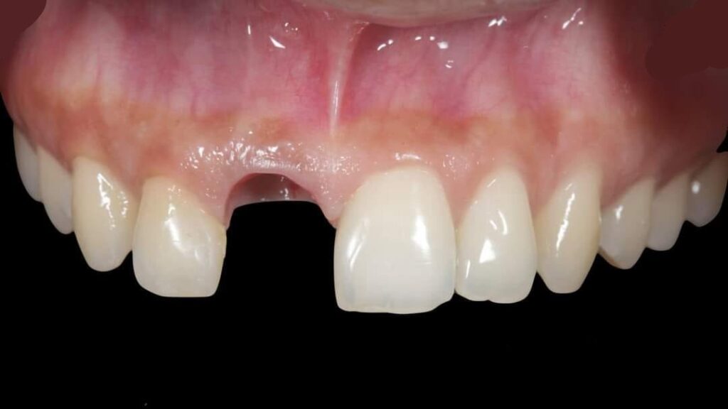 Smilodon Dental + Implants
