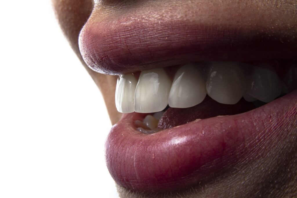 Smilodon Dental + Implants - Happy Adult Teeth