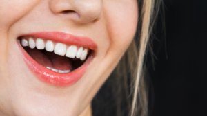 Up close of a smile