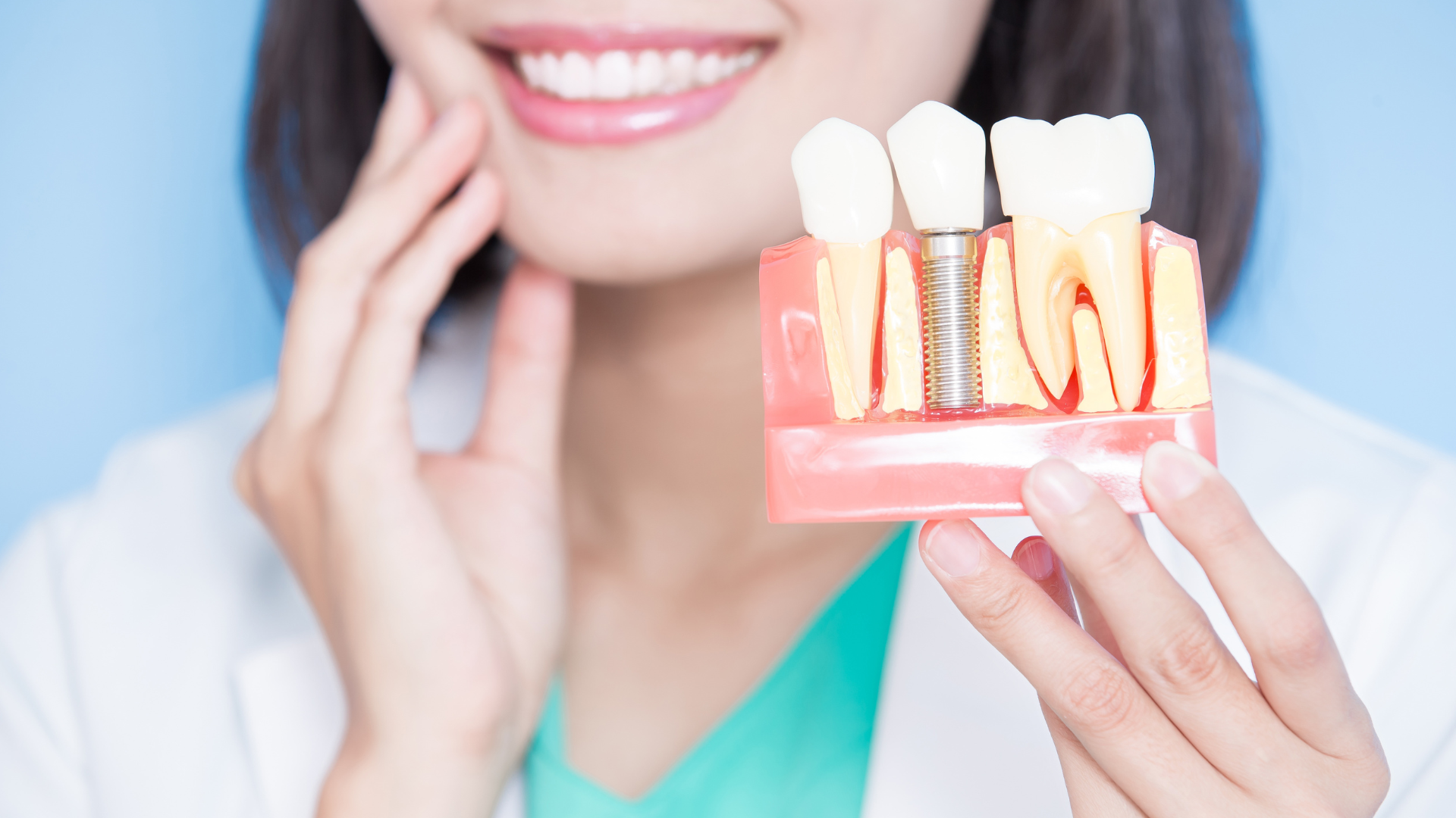 Dental Implants
